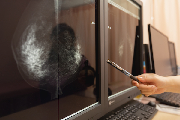 乳腺の病気について