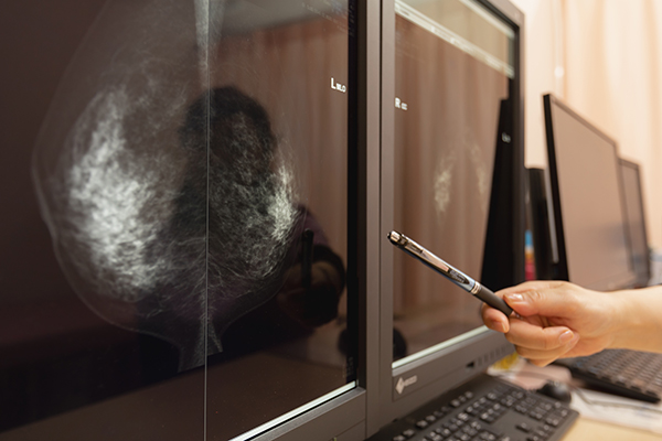 検査の種類について